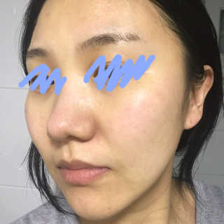 유리스킨-바이오셀룰로오스 마스크 젤리마스크 5매 — 4.17점을 준 리뷰어가 2018년 3월 올린 사용 사진