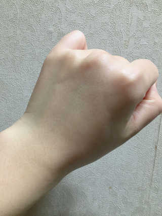 스킨큐어 산다화 비타민씨 화이트닝 에센스 — 3.5점을 준 리뷰어가 2017년 3월 올린 사용 사진