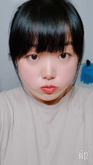 아이디플라코스메틱 아이디 페이스핏 마이너스 밴드 — 5점을 준 리뷰어가 2019년 11월 올린 사용 사진