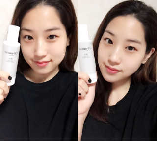올리베리어 듀얼 모이스트 히알루론 에센스 — 4점을 준 리뷰어가 2016년 10월 올린 사용 사진