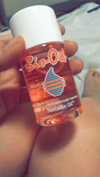 Bio-oil(바이오오일) 바이오오일(Bio-oil) — 4.5점을 준 리뷰어가 2017년 1월 올린 사용 사진