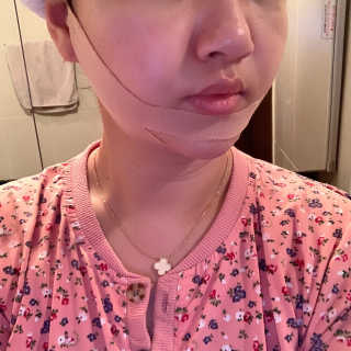 아이디플라코스메틱 아이디 페이스핏 마이너스 밴드 — 5점을 준 리뷰어가 2020년 3월 올린 사용 사진