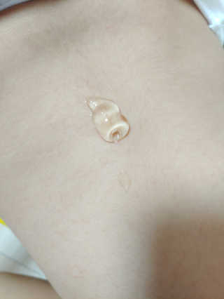 뷰티여우_아토클리닉 [아토클리닉] 아기들이 쓰는 보습, 진정 수딩젤 2개 — 5점을 준 리뷰어가 2019년 7월 올린 사용 사진
