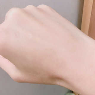 dr.eslee 안티세범 백크네 스프레이 — 5점을 준 리뷰어가 2019년 4월 올린 사용 사진