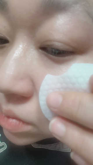 나이팅게일 토닝 필링패드(티트리) — 5점을 준 리뷰어가 2018년 3월 올린 사용 사진