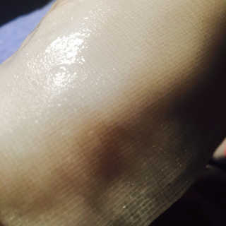 알약님이 올린 리뷰 사진 2