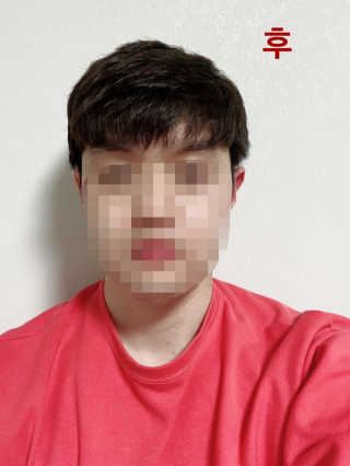 다슈코리아 다슈 포 맨 프리미엄 울트라 본드 젤 다운펌 — 1.5점을 준 리뷰어가 2020년 3월 올린 사용 사진