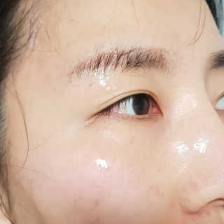 메디힐-엔엠에프＆티트리 안티더스트 카밍 마스크 — 5점을 준 리뷰어가 2019년 3월 올린 사용 사진