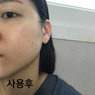홈메디케어 티트리마스크패드 — 4.33점을 준 리뷰어가 2018년 5월 올린 사용 사진