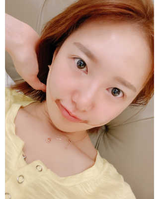 아이디플라코스메틱 아이디 페이스핏 마이너스 밴드 — 3.5점을 준 리뷰어가 2020년 1월 올린 사용 사진
