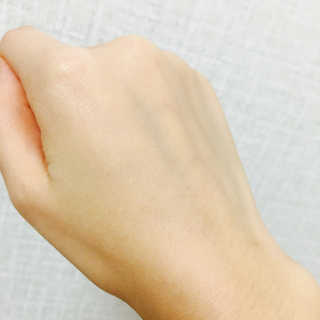 더연 리파이닝 칼라민크림 — 5점을 준 리뷰어가 2017년 11월 올린 사용 사진