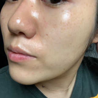 로벡틴 닥터 마스크 아쿠아 — 5점을 준 리뷰어가 2019년 12월 올린 사용 사진