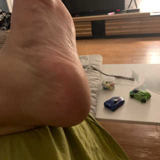 케라셀 풋크림 케라셀 인텐시브 풋 리페어 — 5점을 준 리뷰어가 2019년 10월 올린 사용 사진