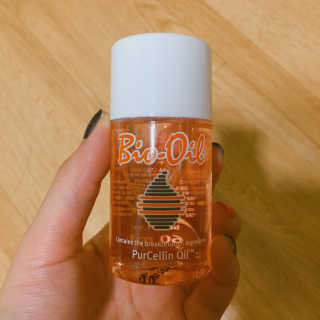 Bio-oil(바이오오일) 바이오오일 — 4.5점을 준 리뷰어가 2016년 10월 올린 사용 사진