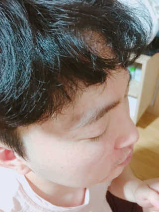 스킨그래머 슈퍼 굿 리페어 에센스 — 3점을 준 리뷰어가 2019년 5월 올린 사용 사진