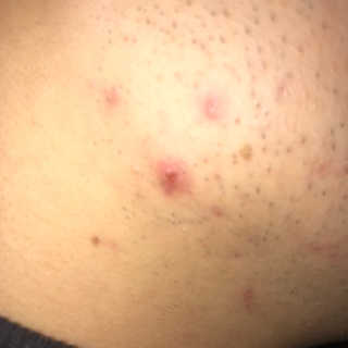 혜띠님이 올린 리뷰 사진 3