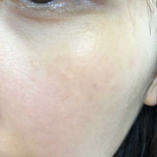 푸츄푸츄 Real repair skin cell premium patch — 2.5점을 준 리뷰어가 2018년 11월 올린 사용 사진