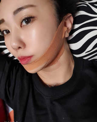 아이디플라코스메틱 아이디 페이스핏 마이너스 밴드 — 5점을 준 리뷰어가 2020년 1월 올린 사용 사진