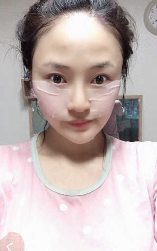 AHC 에이 에이치 씨 미니멀 10 워터리 에센스 — 5점을 준 리뷰어가 2018년 12월 올린 사용 사진