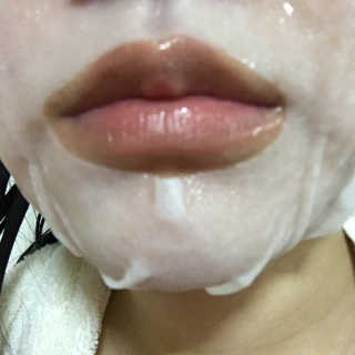 주식회사 태미스 태미스 뉴 히알루론산 마스크팩 10매 — 3점을 준 리뷰어가 2018년 12월 올린 사용 사진
