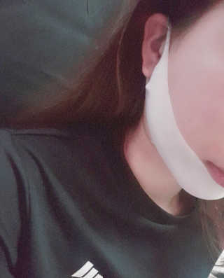 스케덤 클루덤 리프팅 패치 — 4점을 준 리뷰어가 2019년 4월 올린 사용 사진