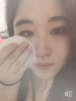 미플레이 진짜 티트리 토너 패드 — 5점을 준 리뷰어가 2018년 11월 올린 사용 사진