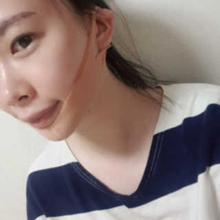 아이디플라코스메틱 아이디 페이스핏 마이너스 밴드 — 4점을 준 리뷰어가 2019년 10월 올린 사용 사진