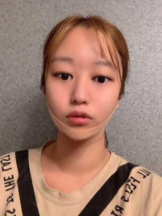 아이디플라코스메틱 아이디 페이스핏 마이너스 밴드 — 5점을 준 리뷰어가 2019년 9월 올린 사용 사진