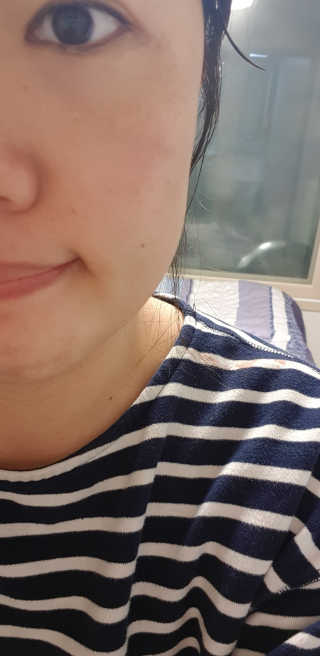 비건화장품 멜릭서 피부 활력 부스터 멜릭서 비타민 세럼 — 4점을 준 리뷰어가 2019년 2월 올린 사용 사진