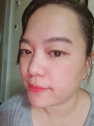 메디페르루테인앰플 3종 — 5점을 준 리뷰어가 2019년 8월 올린 사용 사진