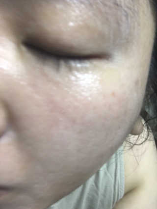 뷰티여우_아토클리닉 [아토클리닉] 아기들이 쓰는 보습, 진정 수딩젤 2개 — 3점을 준 리뷰어가 2019년 7월 올린 사용 사진