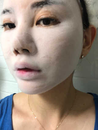 셀퓨전씨 트리악 포어 딜리트 버블 팩 — 5점을 준 리뷰어가 2018년 7월 올린 사용 사진