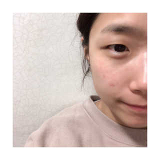 디시크릿 펩타이드 슈퍼 모이스처라이징 에센스 — 4.83점을 준 리뷰어가 2018년 4월 올린 사용 사진