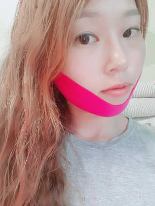 스케덤 펩타이드 리프팅밴드 — 4점을 준 리뷰어가 2019년 6월 올린 사용 사진