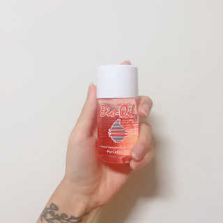 Bio-oil(바이오오일) 바이오오일 — 4점을 준 리뷰어가 2016년 10월 올린 사용 사진