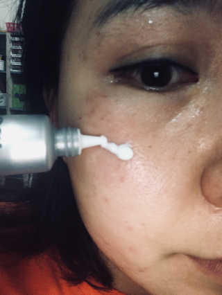 아이소이 불가리안 로즈 블레미쉬 케어 스팟_잡티스팟 — 5점을 준 리뷰어가 2018년 4월 올린 사용 사진