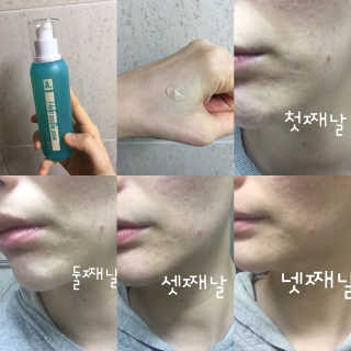 엠씨이 스킨 큐앤에이 솔루션 토너 — 3.17점을 준 리뷰어가 2018년 3월 올린 사용 사진