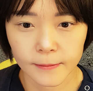오오티유 45도 앵글 선코트 (with OOTU 앱) — 5점을 준 리뷰어가 2017년 10월 올린 사용 사진