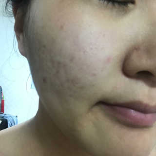 최보배님이 올린 리뷰 사진 2