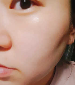 JM솔루션 꿀광 로얄 프로폴리스 앰플 세럼 블랙 — 5점을 준 리뷰어가 2018년 12월 올린 사용 사진