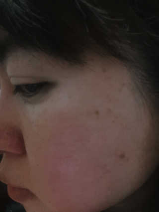 피원피 P1P.AC핑크스킨토너,버블클렌저 세트 — 4.33점을 준 리뷰어가 2018년 4월 올린 사용 사진