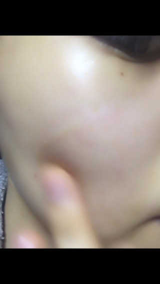 보타니티 [홍]조[진]정[결]케어 플라본 세럼 — 4.17점을 준 리뷰어가 2018년 5월 올린 사용 사진