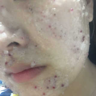 23years old 아쿠아밥 모델링 마스크 — 4점을 준 리뷰어가 2017년 4월 올린 사용 사진