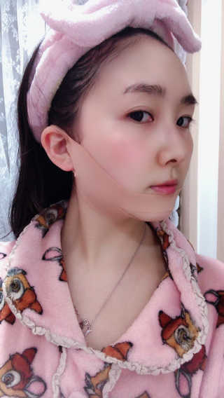아이디플라코스메틱 아이디 페이스핏 마이너스 밴드 — 3점을 준 리뷰어가 2019년 12월 올린 사용 사진