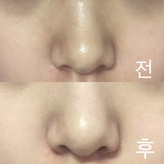 리르화장품 RIRE 올킬 블랙헤드 리무버 스틱 — 4.5점을 준 리뷰어가 2016년 12월 올린 사용 사진