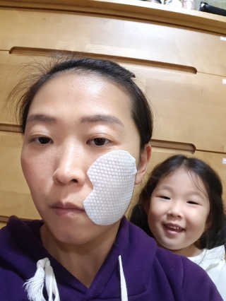 미플레이 진짜 티트리 토너 패드 — 5점을 준 리뷰어가 2018년 11월 올린 사용 사진