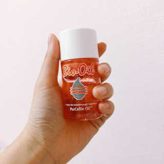 Bio-oil(바이오오일) 바이오오일(Bio-oil) — 2.5점을 준 리뷰어가 2017년 1월 올린 사용 사진