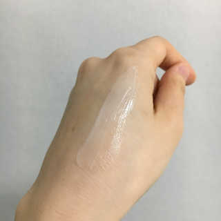 나이팅게일 티타민 크림 리뉴얼 — 5점을 준 리뷰어가 2018년 4월 올린 사용 사진