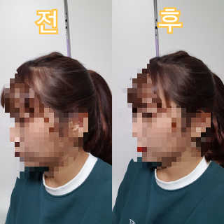 다슈코리아 다슈 안티 헤어로스 헤어쿠션 16g — 4.17점을 준 리뷰어가 2017년 11월 올린 사용 사진