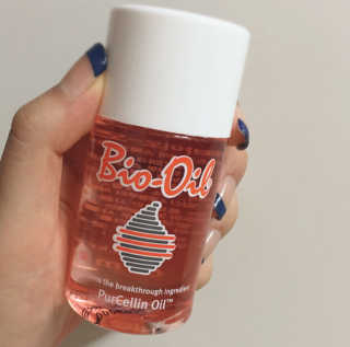 Bio-oil(바이오오일) 바이오오일 — 4.5점을 준 리뷰어가 2016년 10월 올린 사용 사진